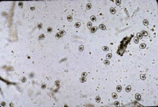 Coccidia